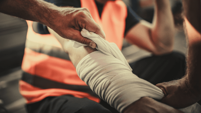 Suffering From a Burn Injury at Work in South Carolina? (Here’s What to Do)